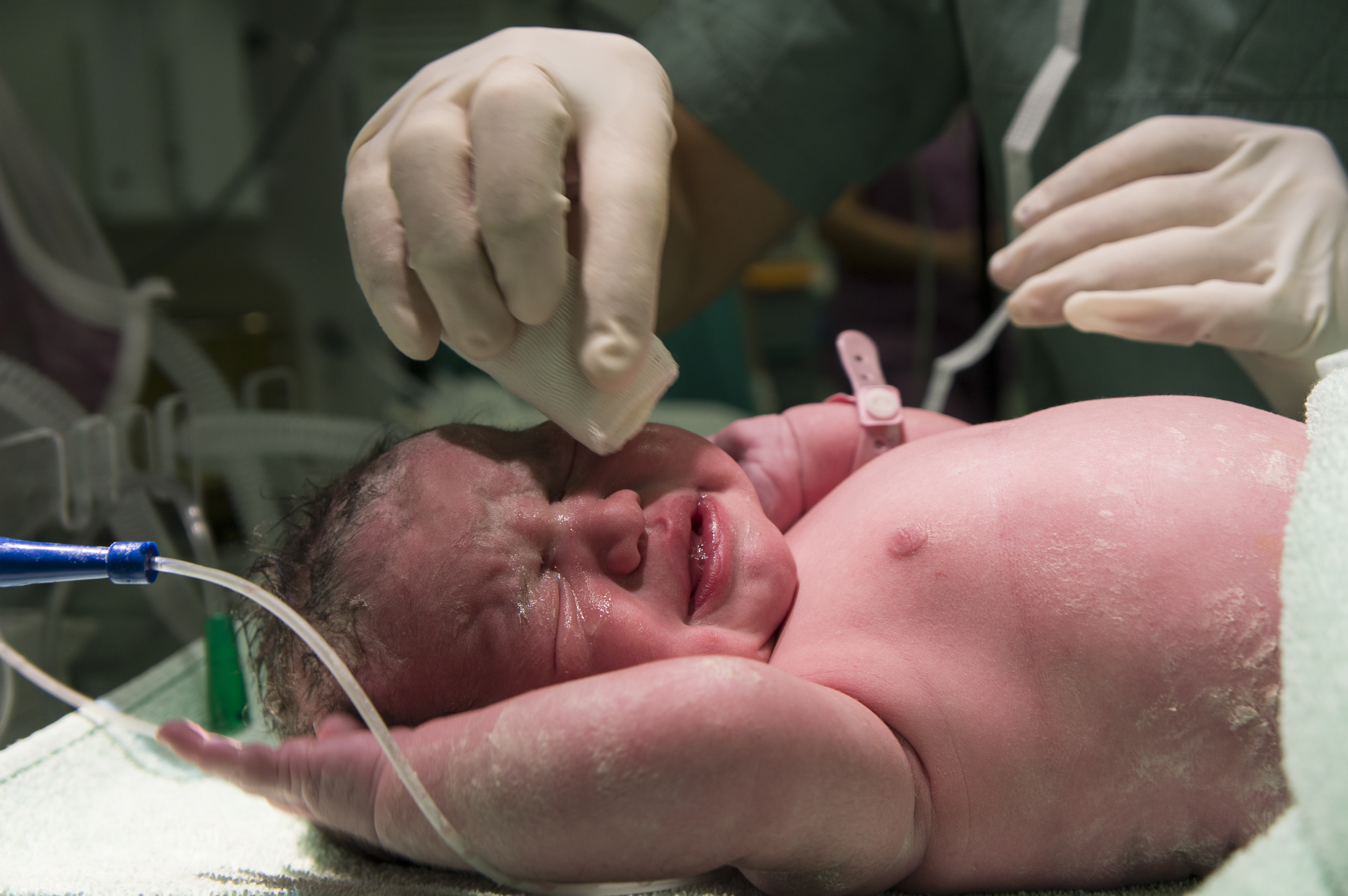 ROP Screening for Newborns